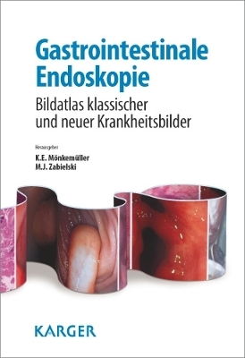 Gastrointestinale Endoskopie - 