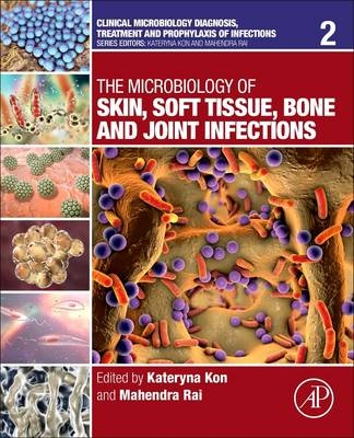 The Microbiology of Skin, Soft Tissue, Bone and Joint Infections - 