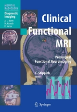 Clinical Functional MRI - 