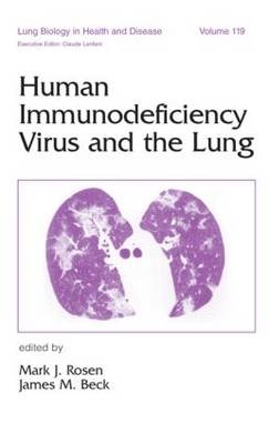 Human Immunodeficiency Virus and the Lung - Mark J. Rosen, James M. Beck