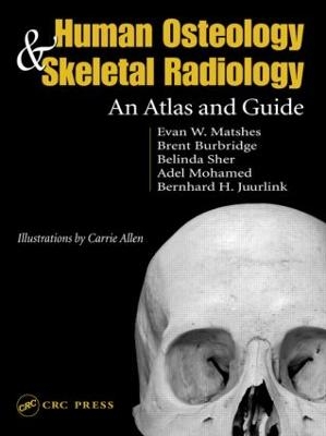 Human Osteology and Skeletal Radiology - Evan W. Matshes, Bernard Juurlink