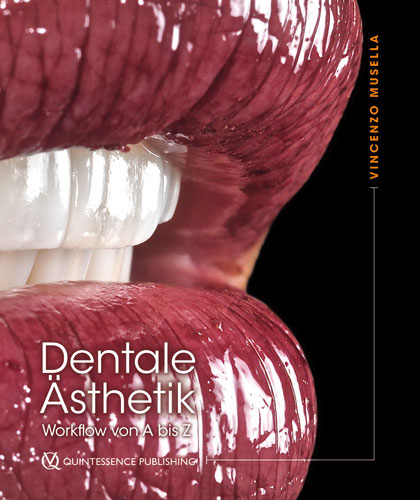 Dentale Ästhetik - Vincenzo Musella