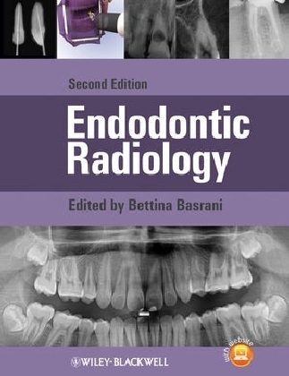 Endodontic Radiology - 