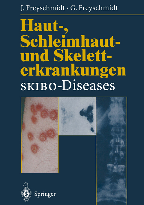 Haut-, Schleimhaut- und Skeletterkrankungen SKIBO-Diseases - Jürgen Freyschmidt, Gisela Freyschmidt