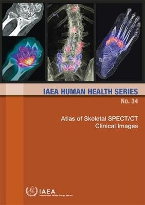 Atlas of Skeletal SPECT/CT Clinical Images -  Iaea
