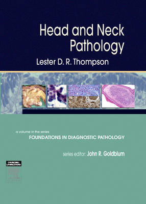 Head and Neck Pathology - Lester D. R. Thompson, Jennifer L. Hunt