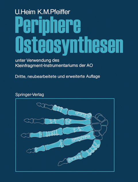 Periphere Osteosynthesen - Urs Heim, Karl M. Pfeiffer
