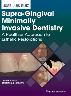 Supra-Gingival Minimally Invasive Dentistry - Jose-Luis Ruiz