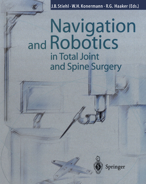 Navigation and Robotics in Total Joint and Spine Surgery - 