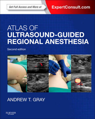 Atlas of Ultrasound-Guided Regional Anesthesia - Andrew T. Gray