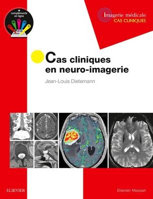 Cas Cliniques En Neuro-Imagerie - Jean-Louis Dietemann