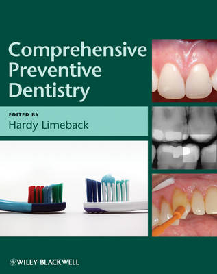 Comprehensive Preventive Dentistry - 