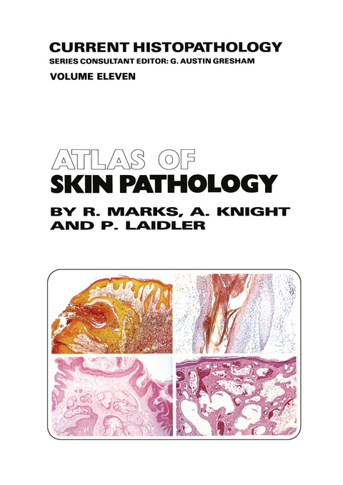 Atlas of Skin Pathology - R.M. Marks, A.G. Knight, P. Laidler