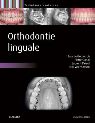 Orthodontie Linguale - Pierre Canal, Laurent Delsol, Dirk Wiechmann