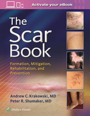 The Scar Book - Dr. Andrew C. Krakowski, Dr. Peter R. Shumaker