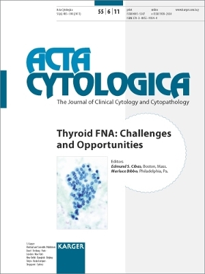 Thyroid FNA: Challenges and Opportunities - 