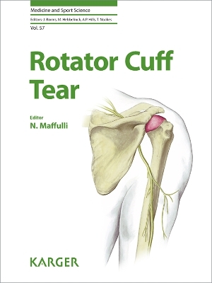 Rotator Cuff Tear - 