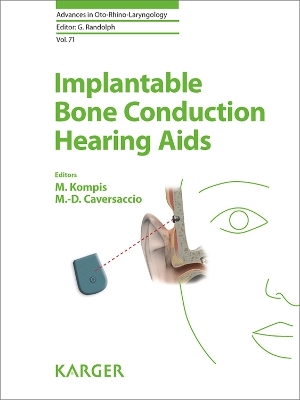 Implantable Bone Conduction Hearing Aids - 
