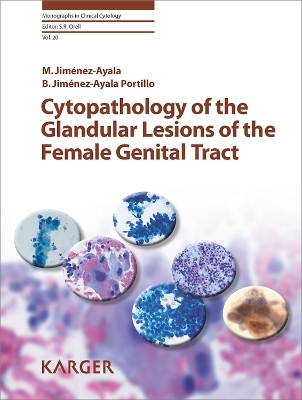 Cytopathology of the Glandular Lesions of the Female Genital Tract -  Jiménez-Ayala,  Jiménez-Ayala Portillo