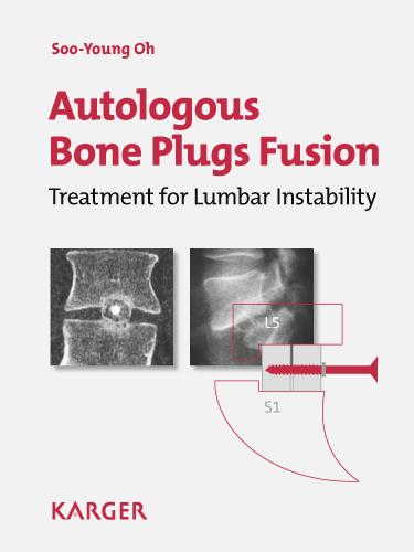 Autologous Bone Plugs Fusion - S.-Y. Oh