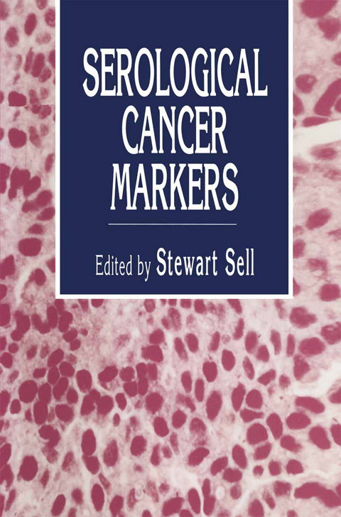 Serological Cancer Markers - 