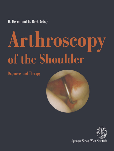 Arthroscopy of the Shoulder - 