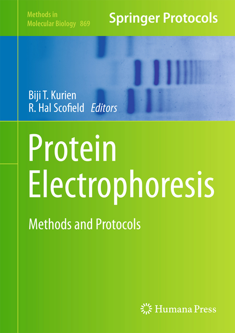Protein Electrophoresis - 