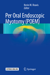 Per Oral Endoscopic Myotomy (POEM) - 