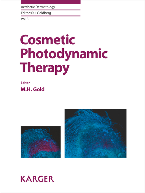 Cosmetic Photodynamic Therapy - 