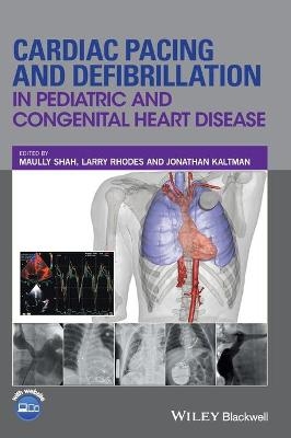 Cardiac Pacing and Defibrillation in Pediatric and Congenital Heart Disease - 