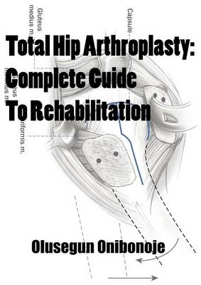 Total Hip Arthroplasty - Olusegun Onibonoje