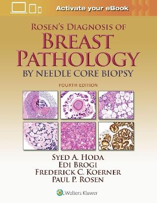 Rosen's Diagnosis of Breast Pathology by Needle Core Biopsy - Syed A. Hoda, Paul Peter Rosen, Edi Brogi, Frederick C. Koerner