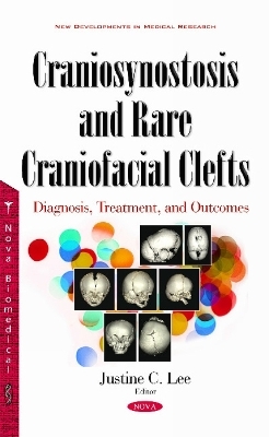 Craniosynostosis & Rare Craniofacial Clefts - 