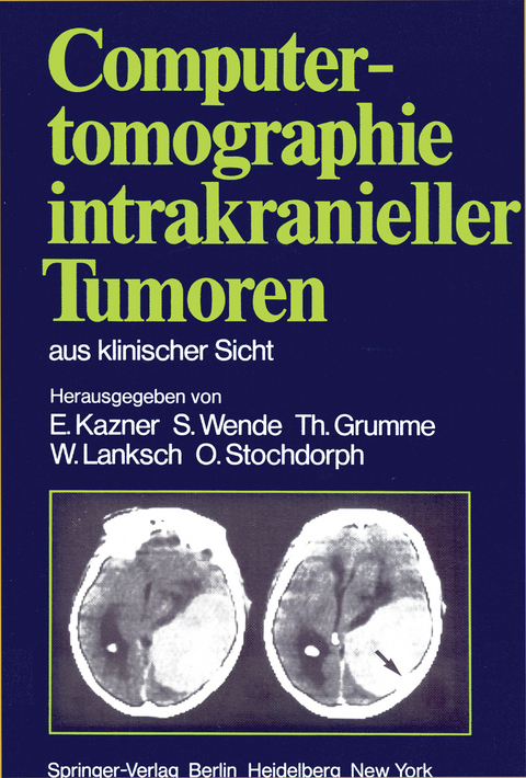 Computertomographie intrakranieller Tumoren aus klinischer Sicht - 