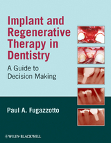 Implant and Regenerative Therapy in Dentistry -  Paul A. Fugazzotto