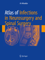 Atlas of Infections in Neurosurgery and Spinal Surgery -  Ali Akhaddar