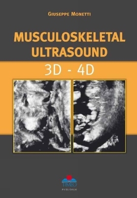 Musculoskeletal Ultrasound 3D-4D - Giuseppe Monetti