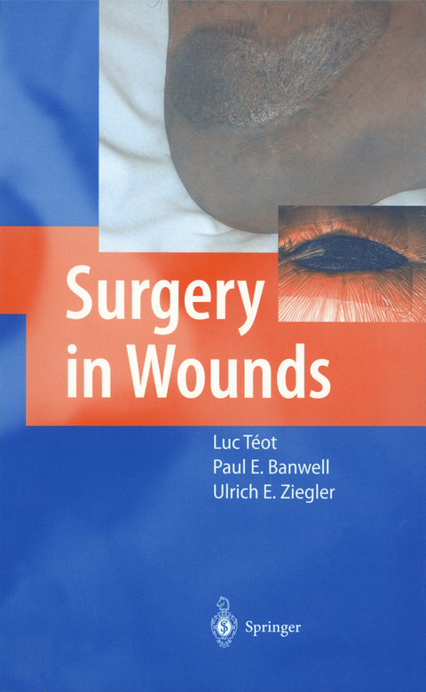 Surgery in Wounds - 