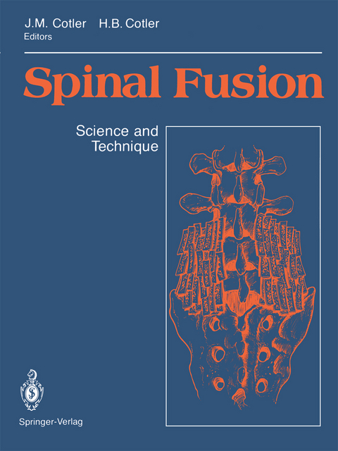 Spinal Fusion - 