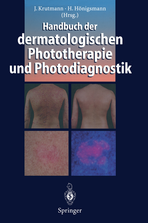 Handbuch der dermatologischen Phototherapie und Photodiagnostik - 