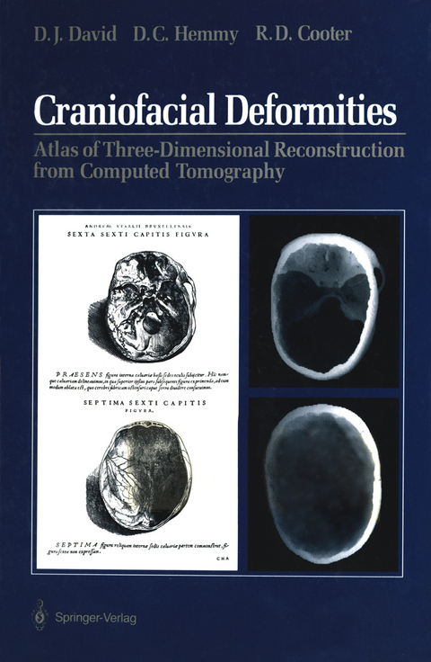 Craniofacial Deformities - David J. David, David C. Hemmy, Rodney D. Cooter