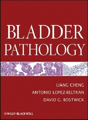 Bladder Pathology - Liang Cheng, Antonio Lopez-Beltran, David G. Bostwick
