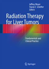 Radiation Therapy for Liver Tumors - 