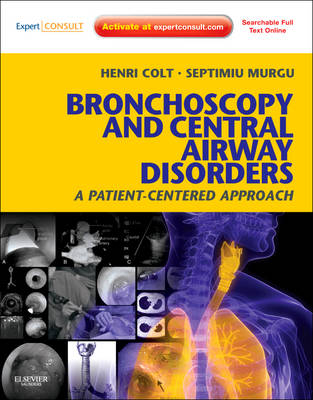 Bronchoscopy and Central Airway Disorders - Henri Colt, Septimiu Murgu