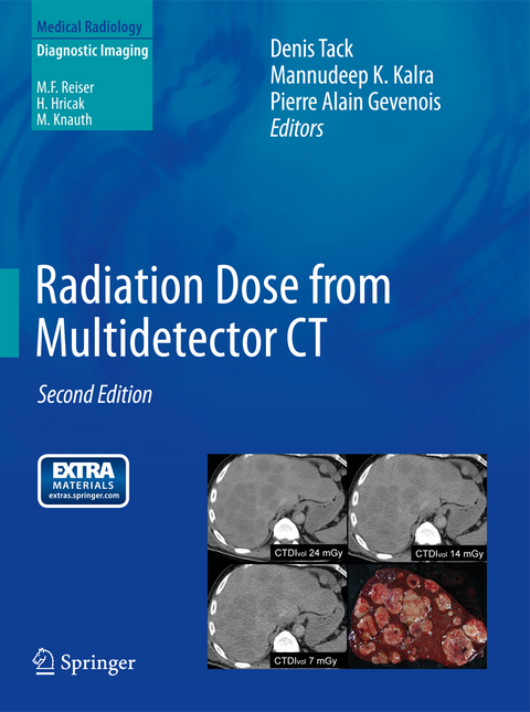 Radiation Dose from Multidetector CT - 