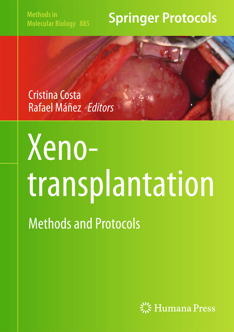 Xenotransplantation - 