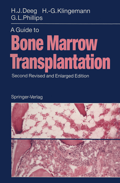 A Guide to Bone Marrow Transplantation - H.Joachim Deeg, Hans-Georg Klingemann, Gordon L. Phillips