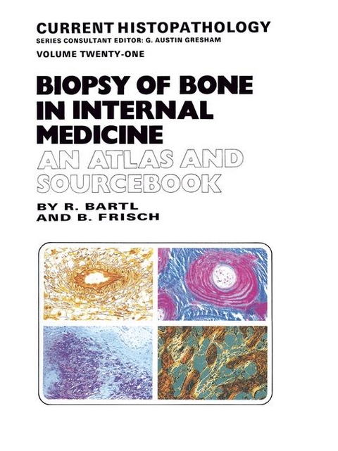Biopsy of Bone in Internal Medicine - Reiner Bartl, Bertha Frisch
