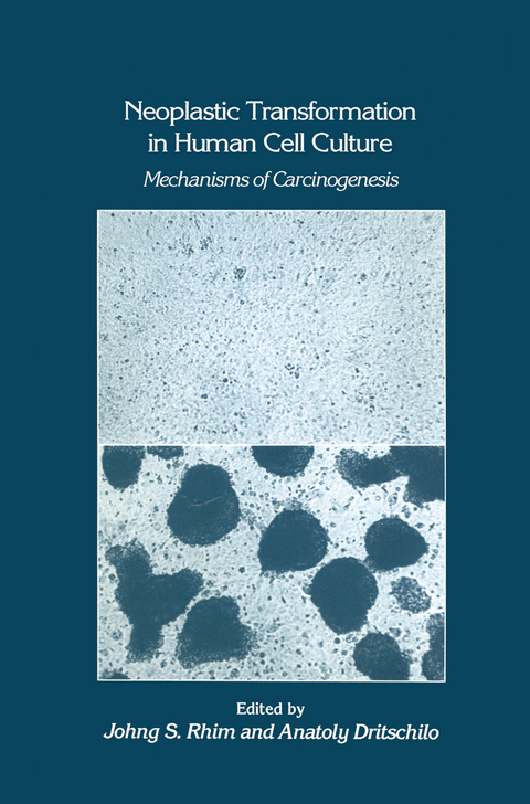Neoplastic Transformation in Human Cell Culture - Johng S. Rhim, Anatoly Dritschilo