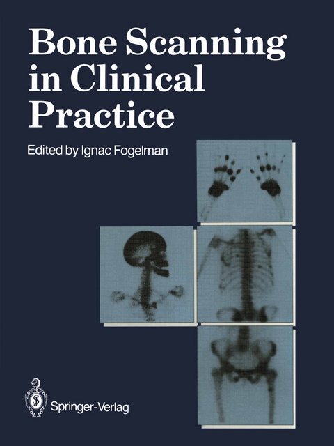 Bone Scanning in Clinical Practice - 